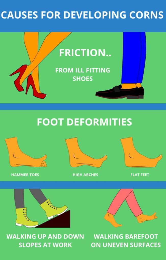 What Causes Corns On Feet Infographic