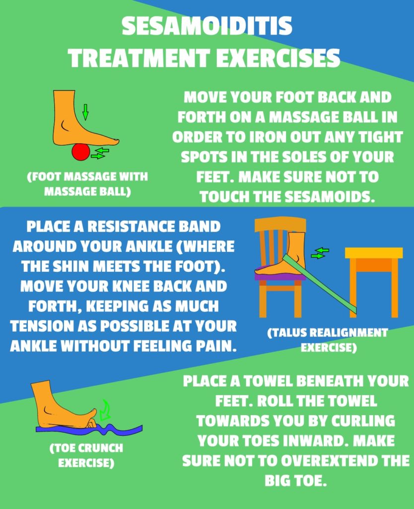 SESAMOIDITIS TREATMENT EXERCISES