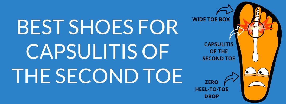BEST SHOES FOR CAPSULITIS OF THE SECOND TOE