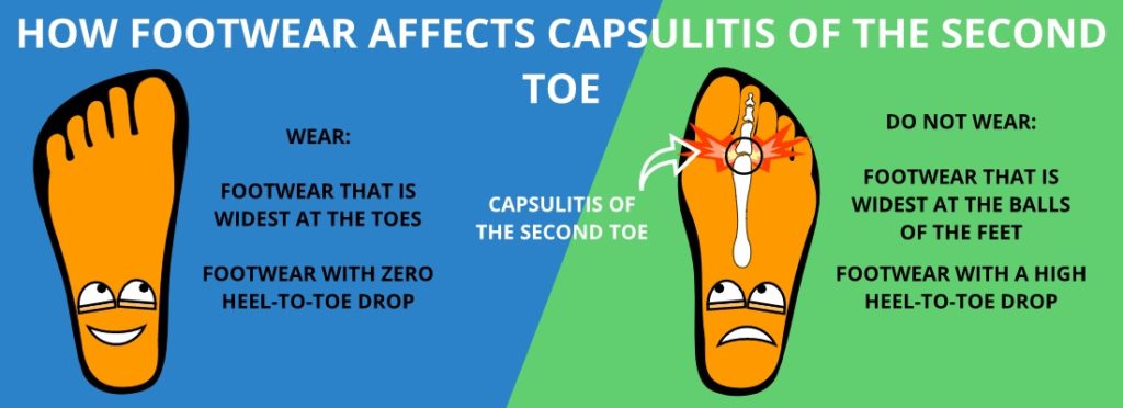 BEST TYPES OF SHOES TO WEAR FOR CAPSULITIS OF THE SECOND TOE