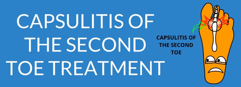 CAPSULITIS OF THE SECOND TOE TREATMENT